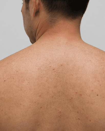 Back & Shoulders: before
