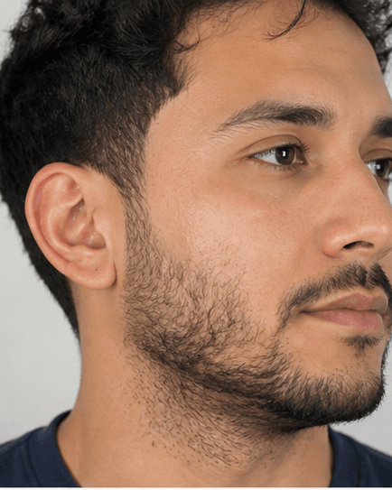 Beard Line Shaping: before