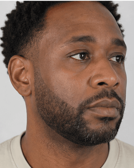 Beard Line Shaping: after