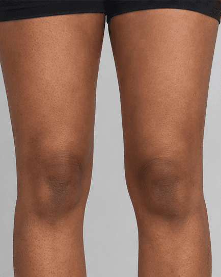 Full Legs: after
