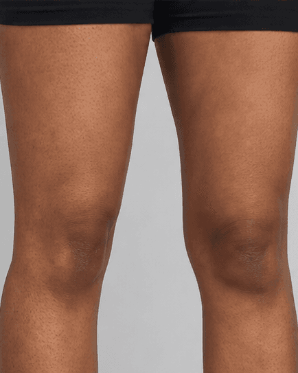Full Legs: before