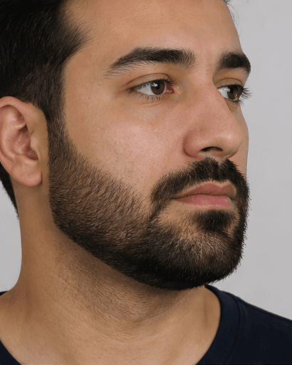 Beard Shaping (Men): after