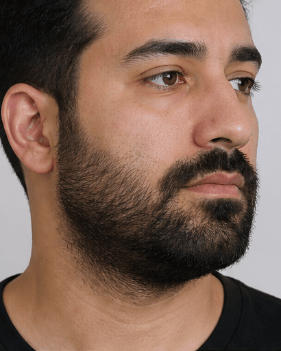 Beard Shaping (Men): before
