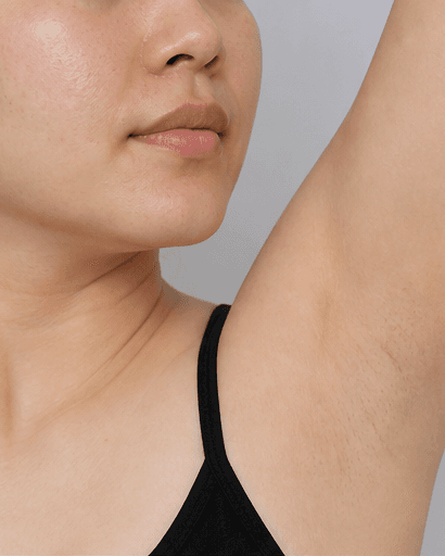 Underarms: after