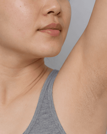 Underarms: before