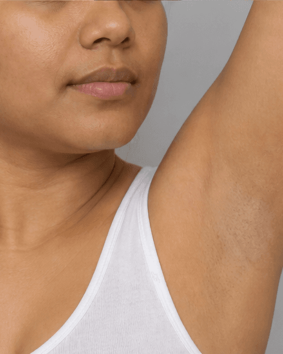 Underarms: after