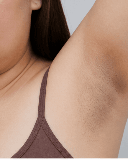 Underarms: before