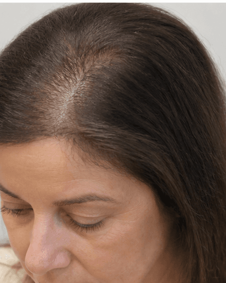 Clinical Scalp Detox: after