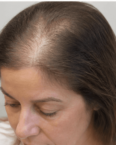 Clinical Scalp Detox: before