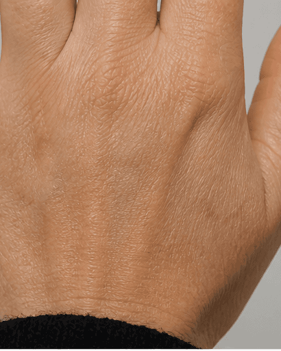 Complete Hand Programme: after