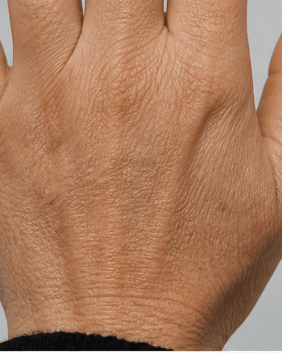 Complete Hand Programme: before