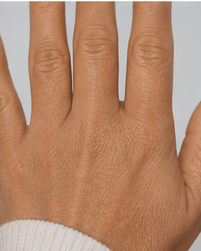 Complete Hand Programme: after