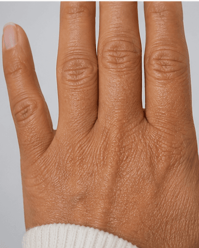 Complete Hand Programme: before