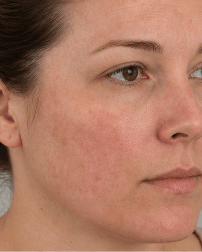Laser Genesis: before
