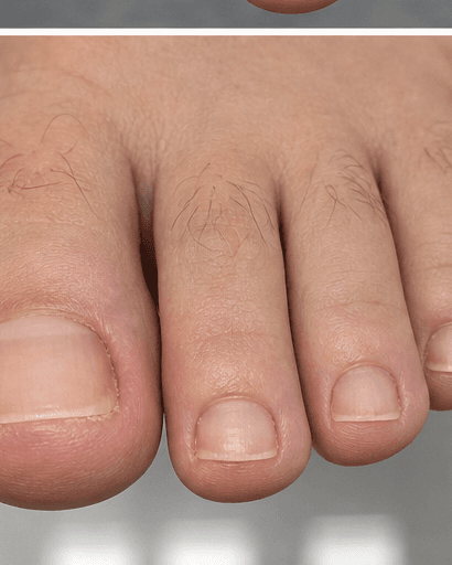 Fungal Nail Treatment: after