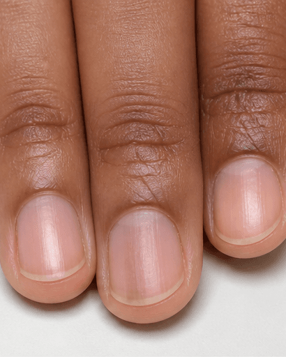 Nail Pigment Band Review: after