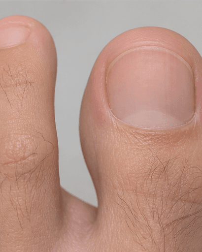 Nail Pigment Band Review: after