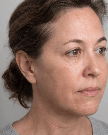 Regenerative Consultation: before