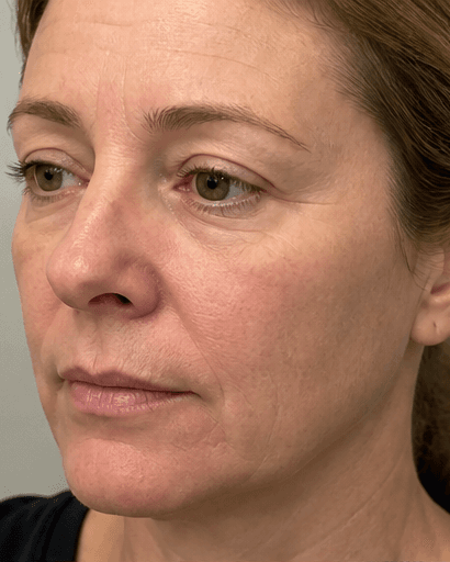 Conditioned Media Therapy: before