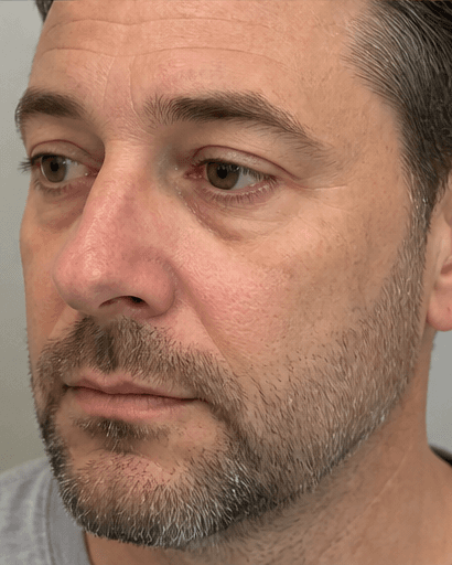 Conditioned Media Therapy: before