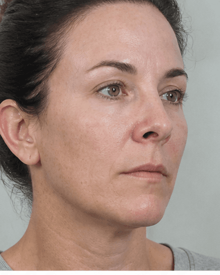 Full Skin Examination: after
