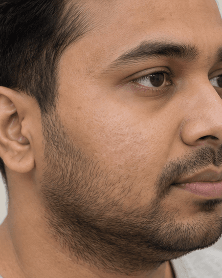 Fungal Infection Treatment: after