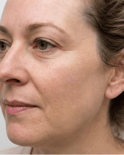 Mole & Skin Check: after