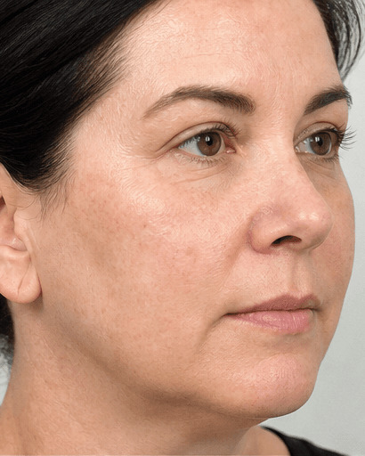 Teledermatology Review: after