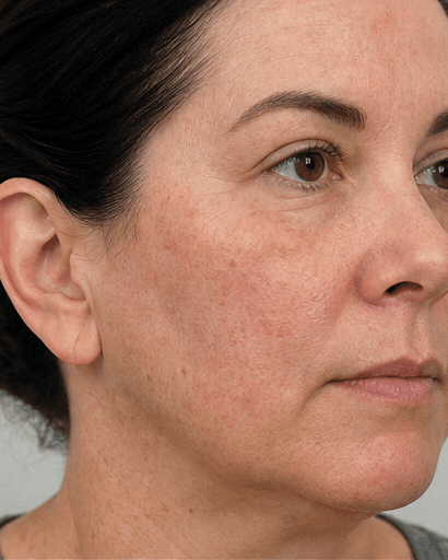 Teledermatology Review: before