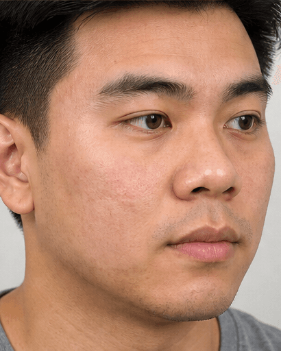 Teledermatology Review: after