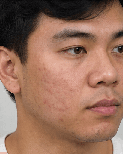 Teledermatology Review: before