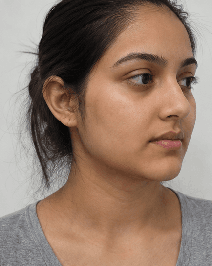 Body Odour Management: before