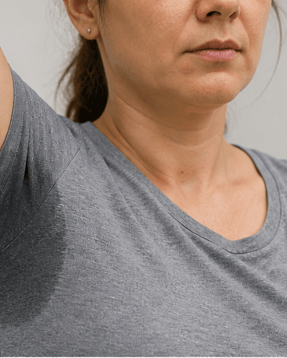 Hyperhidrosis Assessment: before