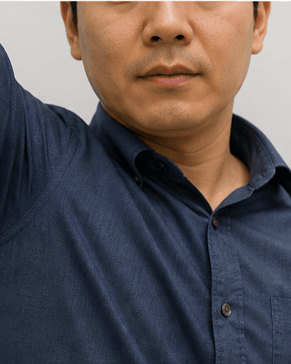 Hyperhidrosis Assessment: after