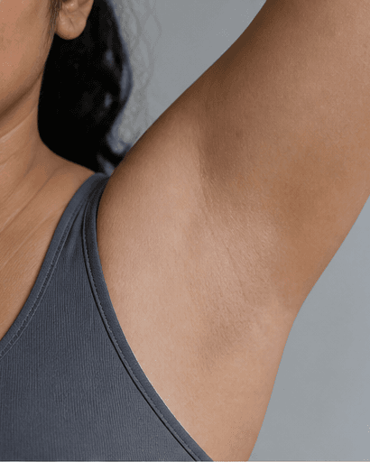 Underarm Treatment: after