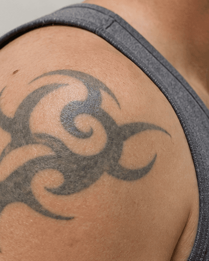 Black Ink Removal: before