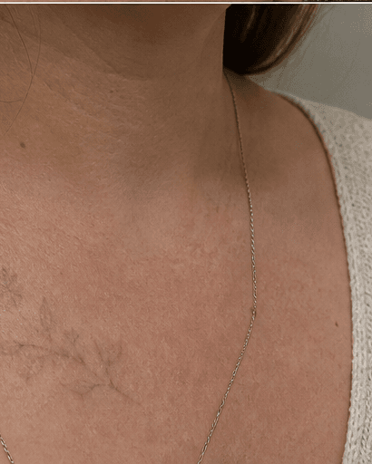 Black Ink Removal: after