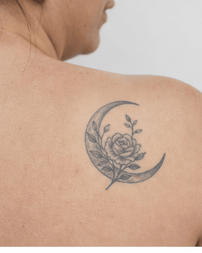 Post-Tattoo Scar Treatment: before