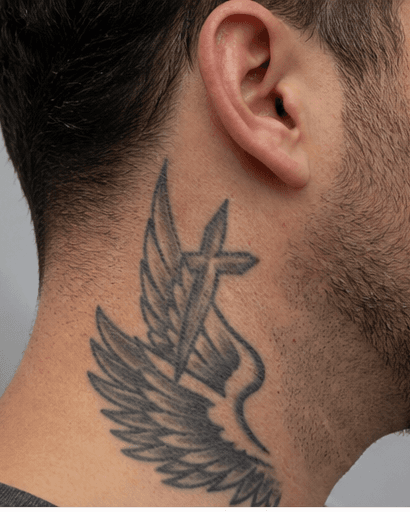 Tattoo Fading for Cover-Up: before