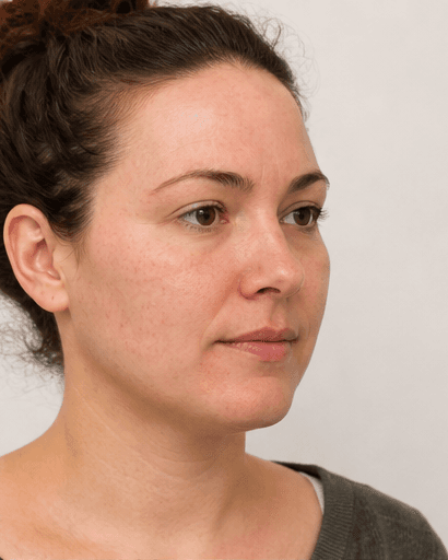 Food Sensitivity Review: after