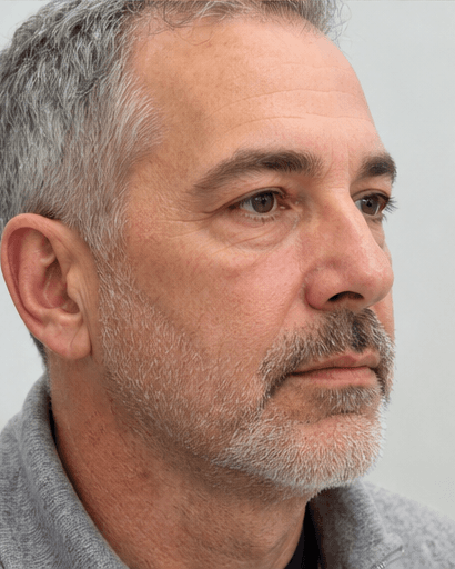 Immunity Support Infusion: after
