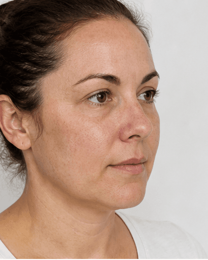 Skin Health Blood Panel: after