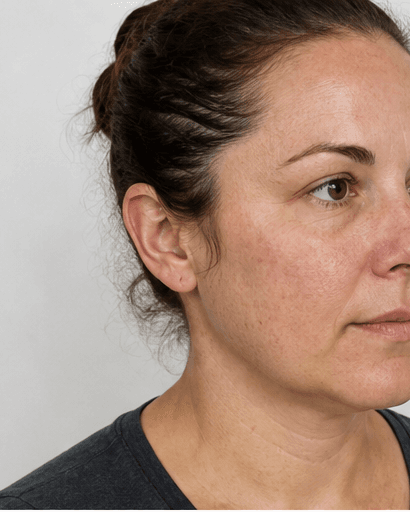 Skin Health Blood Panel: before