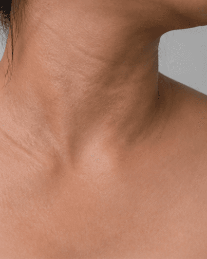 Intimate Pigmentation Care: before