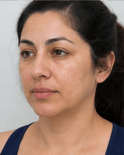 Post-Partum Assessment: after