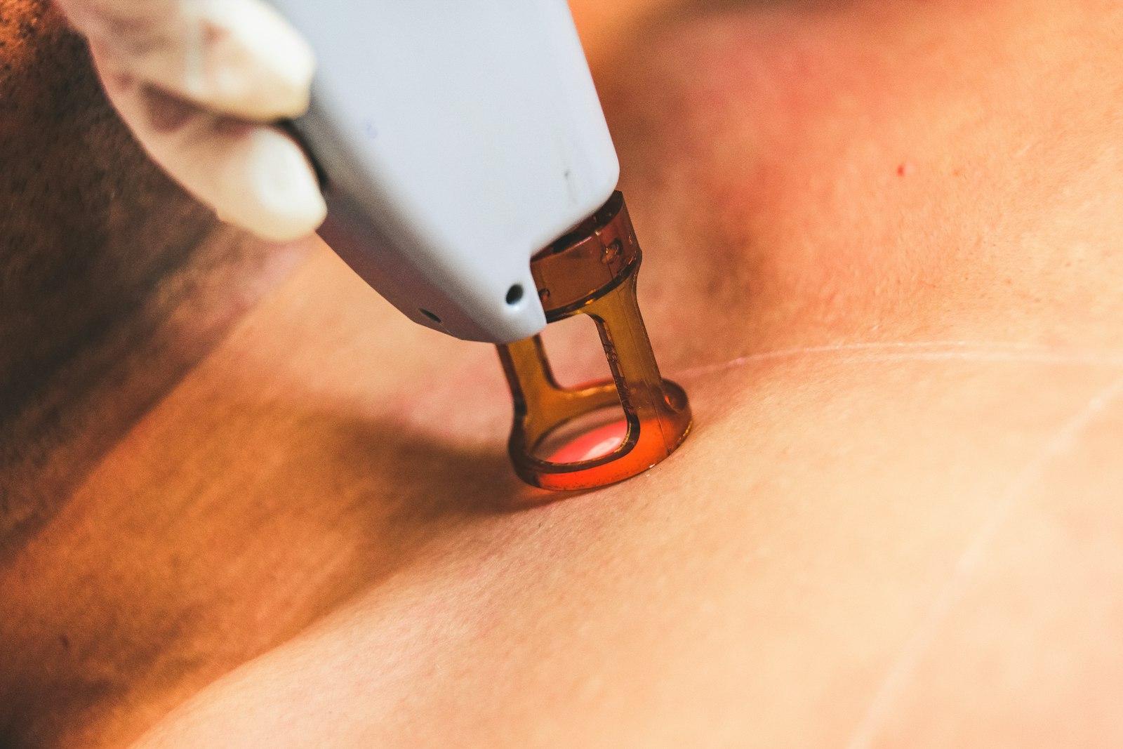 Low-Level Laser Therapy