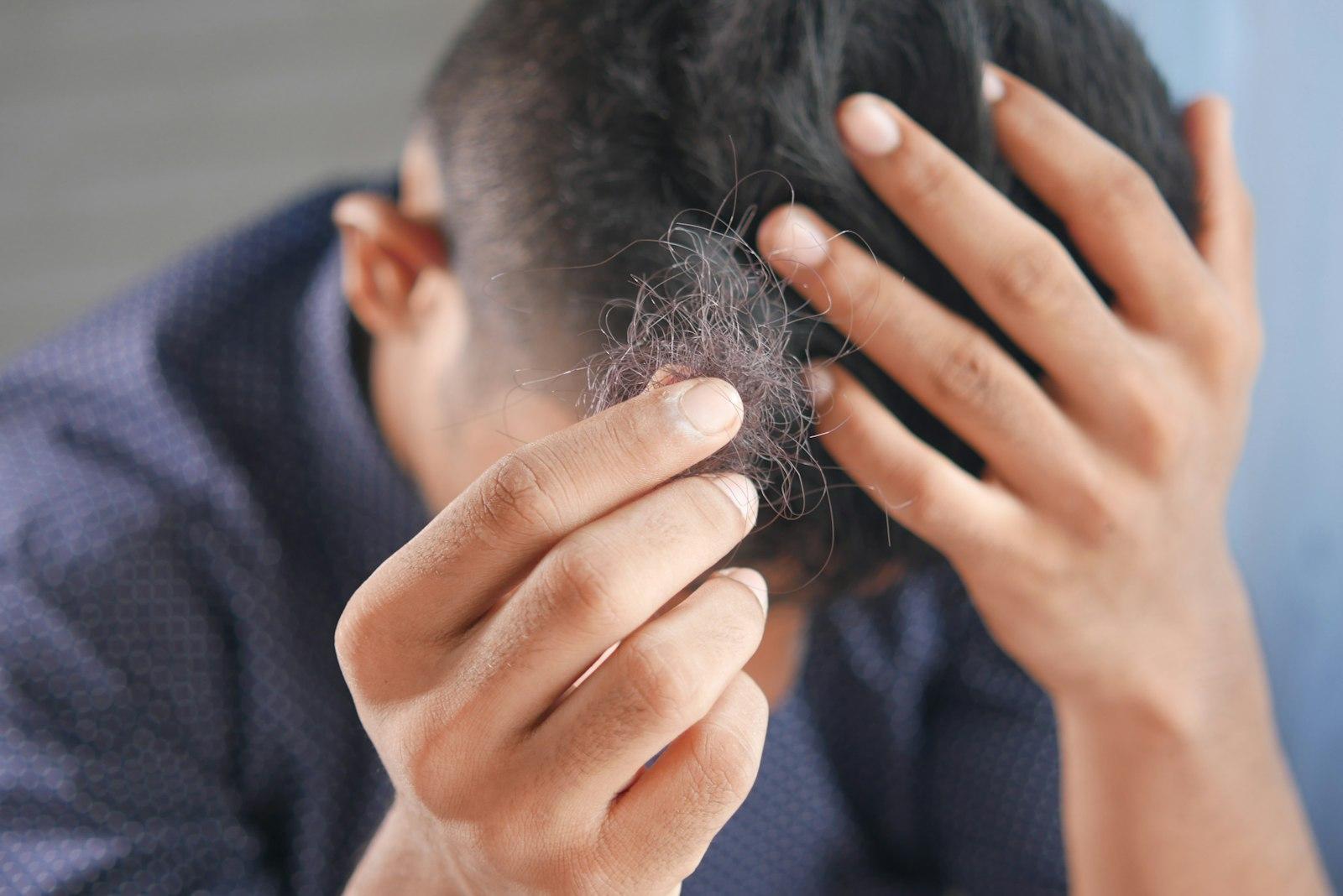 PRP Hair Therapy