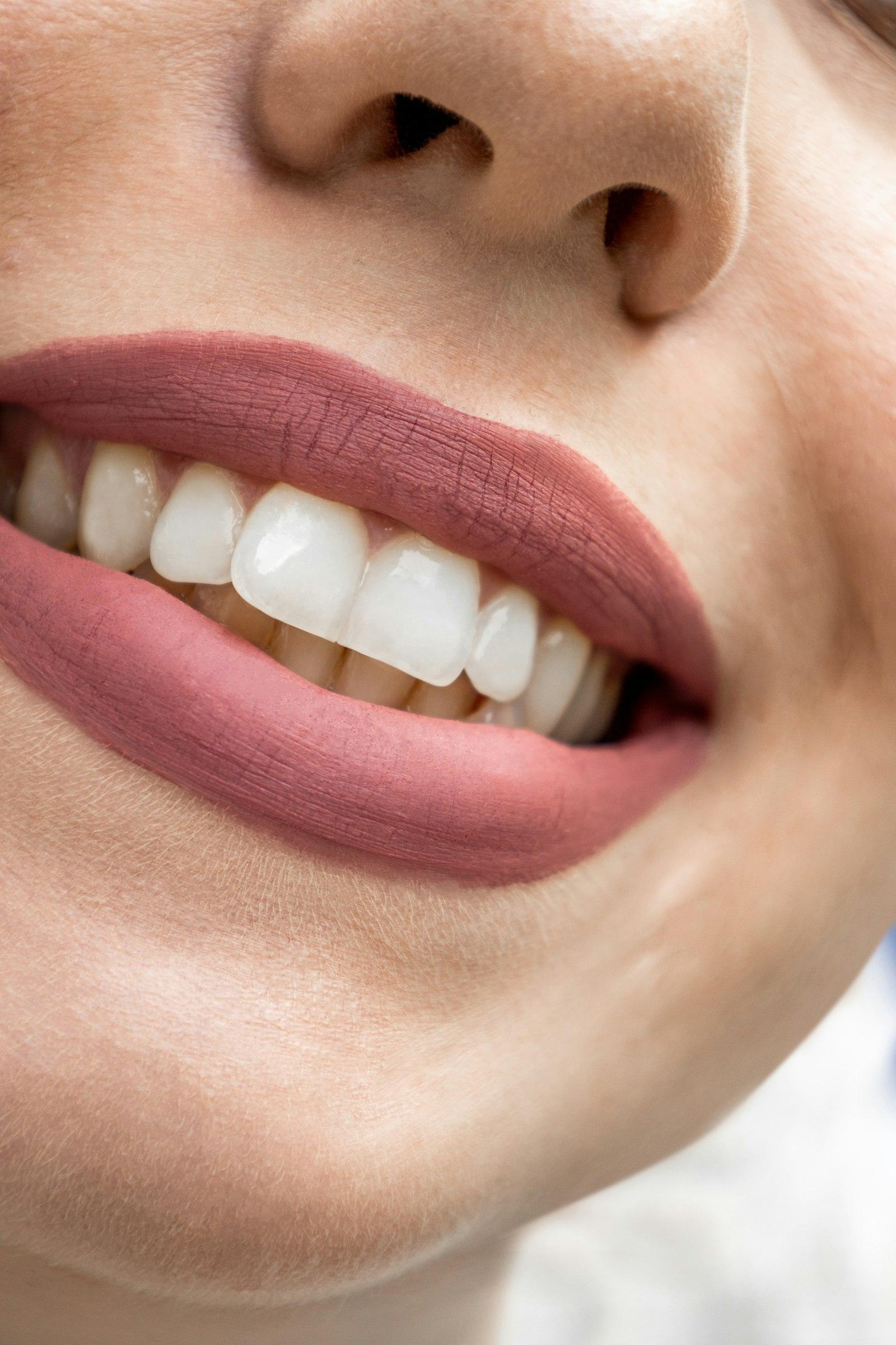 Smile Design Consult
