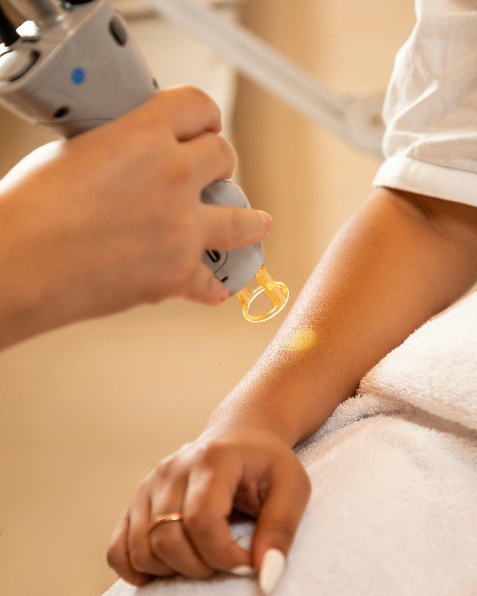 Hormonal Acne Assessment