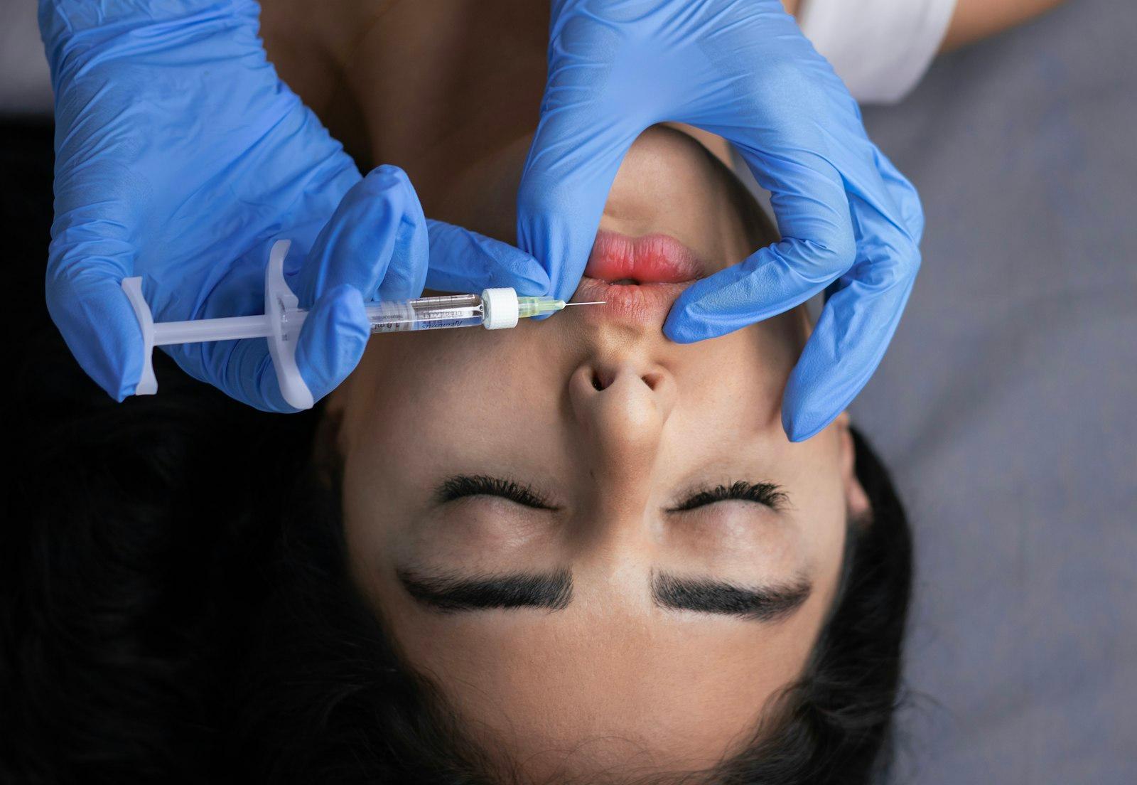 Gummy Smile Correction